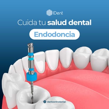 Endodoncia