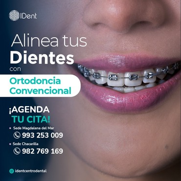 Ortodoncia con Brackets